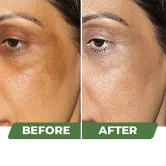 Organic Skin Brightening Cream 100 gm (Pack of 2)